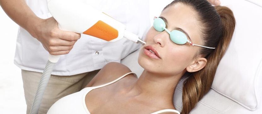 Лазерно възстановяване на кожата