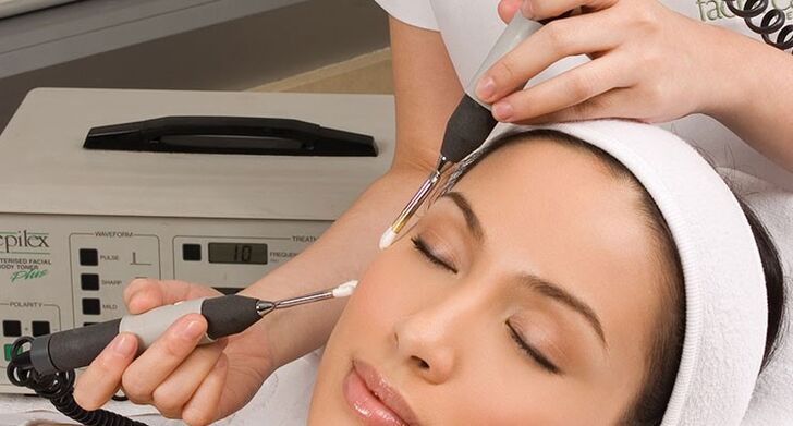 Предимства